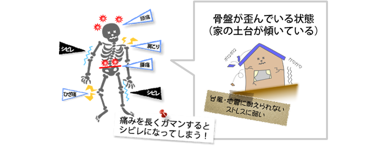 骨盤はどうしてゆがむの